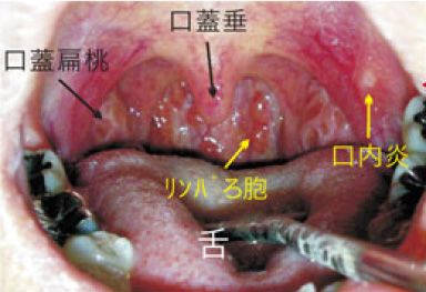 の 左側 痛い 喉 が 唾を飲むと左側の喉が痛い！この原因となる7つの病気